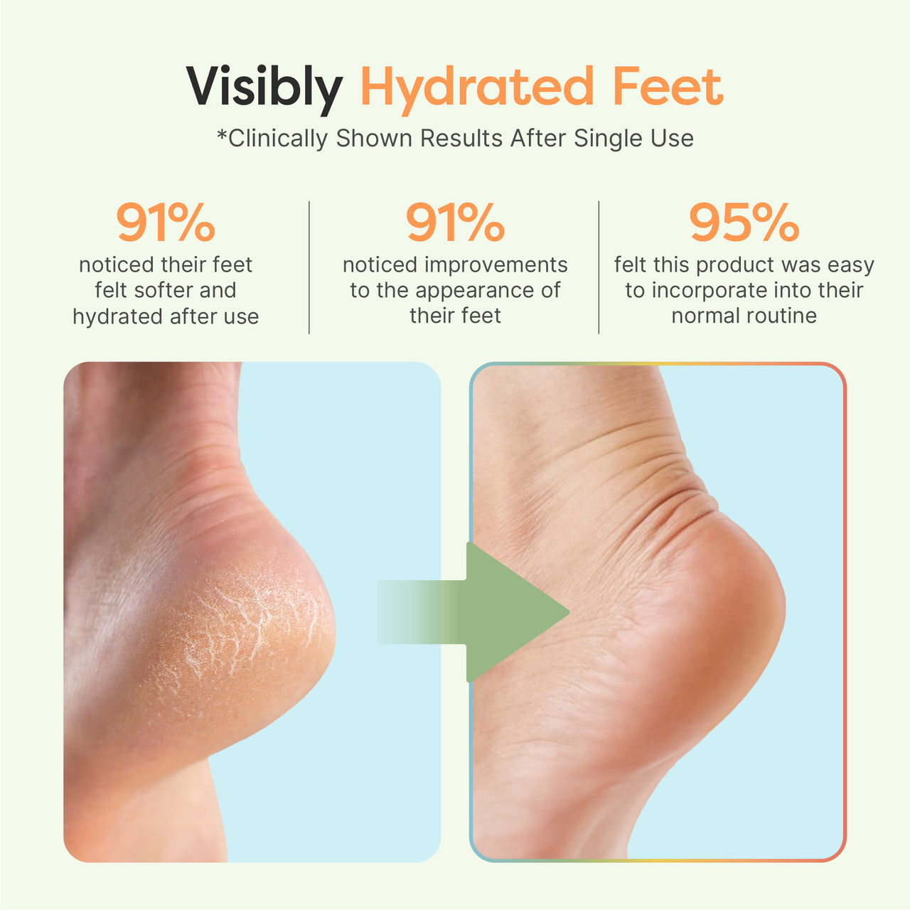 Moisturizing Gel Heel Socks - Fuzzy - ZenToes