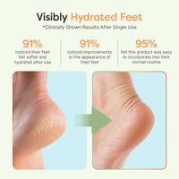 Thumbnail for Moisturizing Gel Heel Socks - Fuzzy - ZenToes