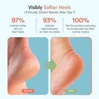 Thumbnail for Fuzzy Moisturizing Gel Heel Socks - Wide Width - ZenToes