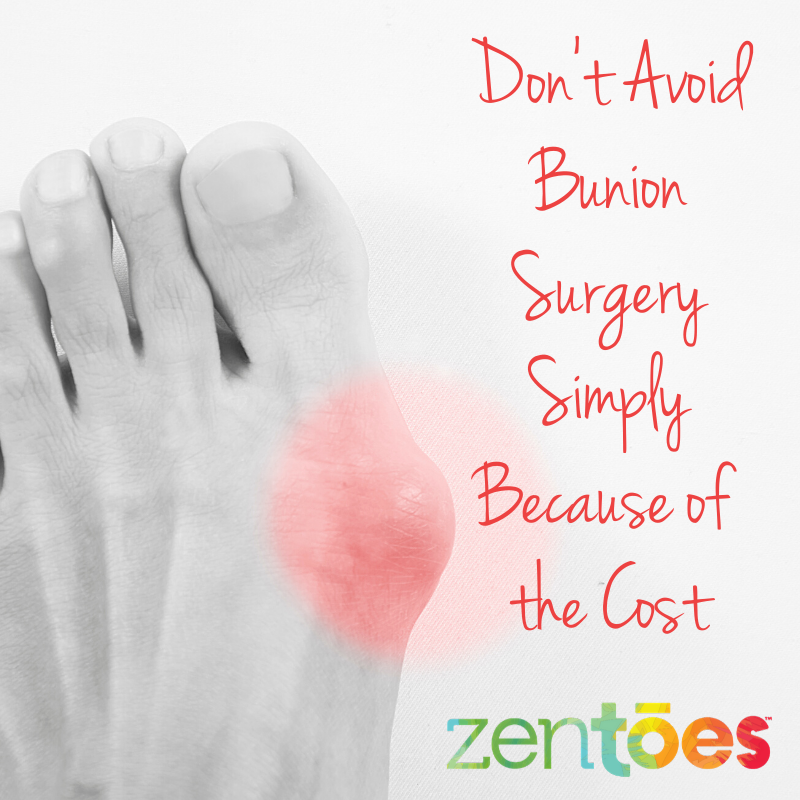 What You Need to Know About the Cost of Bunion Surgery