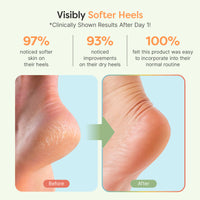 Thumbnail for Moisturizing Gel Heel Socks - Fuzzy