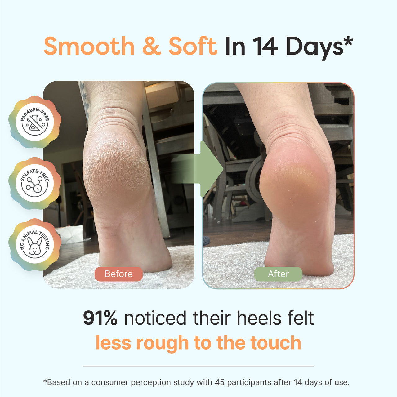 Urea Foot Cream