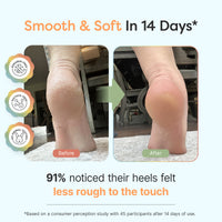 Thumbnail for Urea Foot Cream