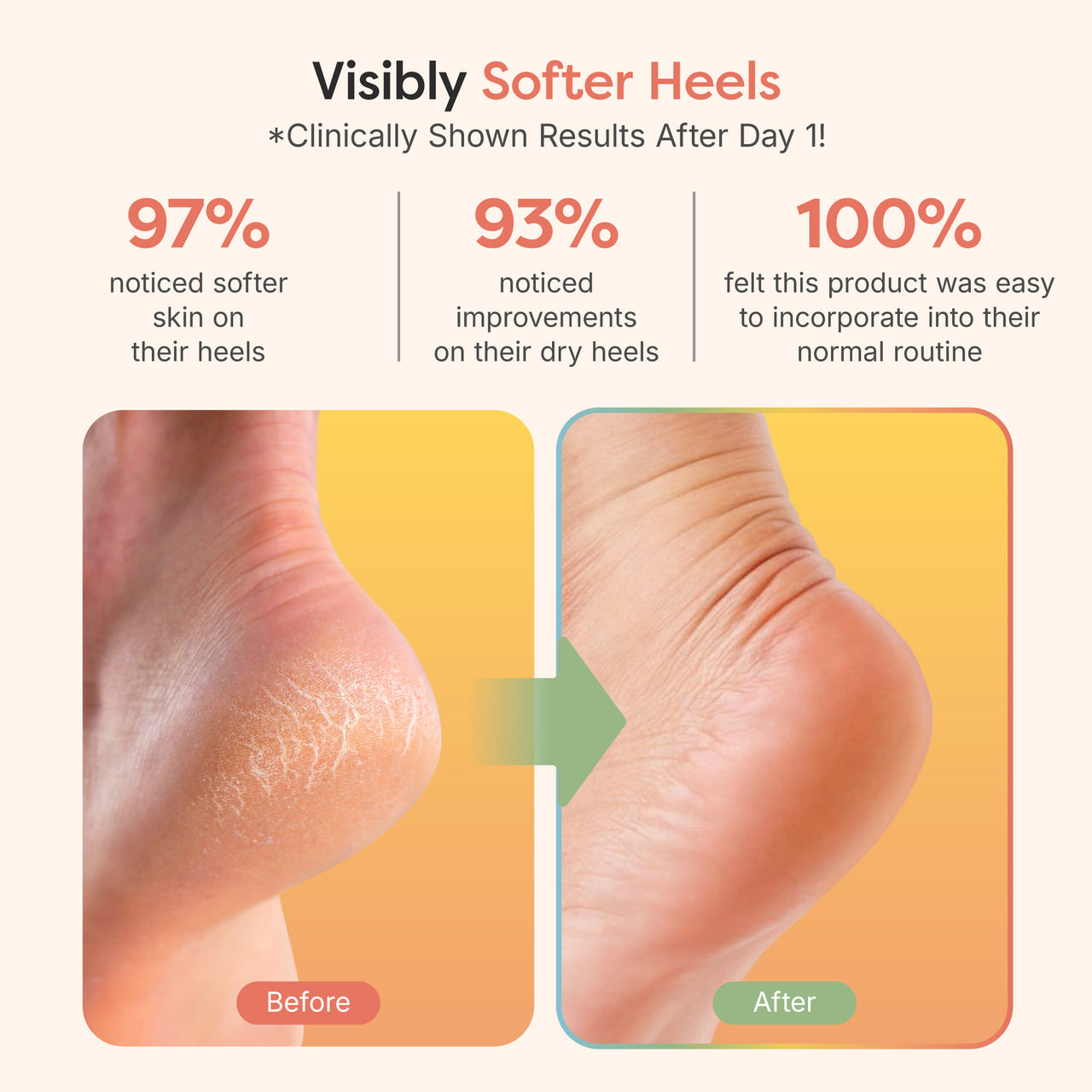 Moisturizing Gel Heel Socks - Fuzzy