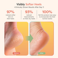 Thumbnail for Moisturizing Gel Heel Socks - Fuzzy