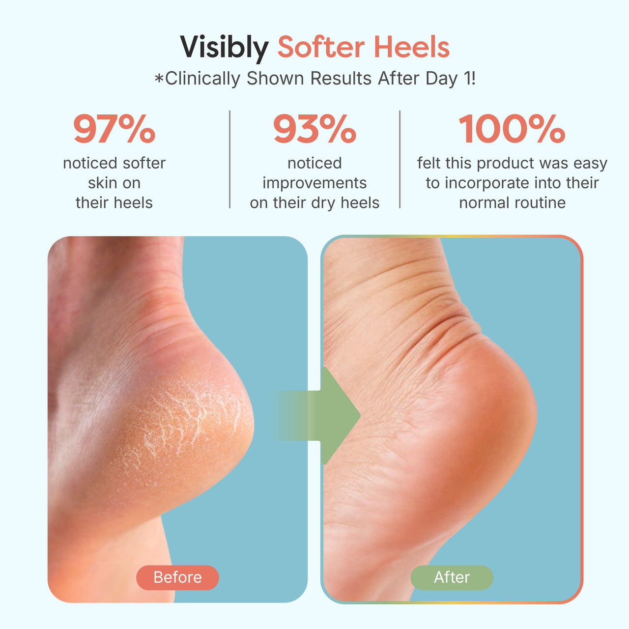 Fuzzy Moisturizing Gel Heel Socks - Wide Width